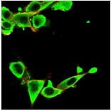 Immunofluorescence - Anti-IGFBP3 Antibody [IGFBP3/3424] (A277660) - Antibodies.com