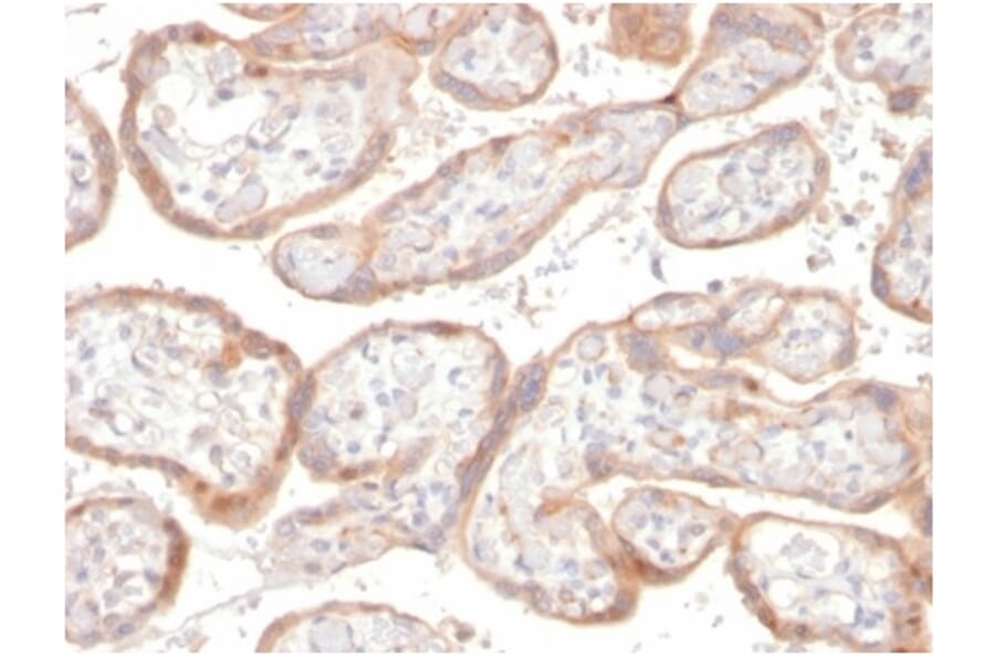 Immunohistochemistry - Anti-IGFBP3 Antibody [IGFBP3/3517] (A277661) - Antibodies.com