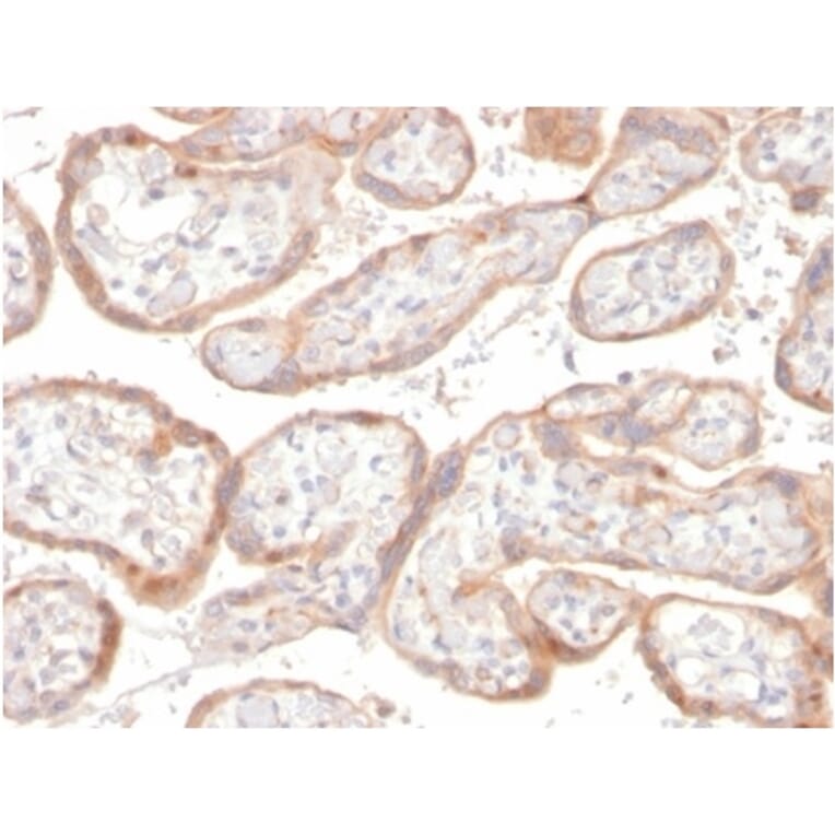 Immunohistochemistry - Anti-IGFBP3 Antibody [IGFBP3/3517] (A277661) - Antibodies.com