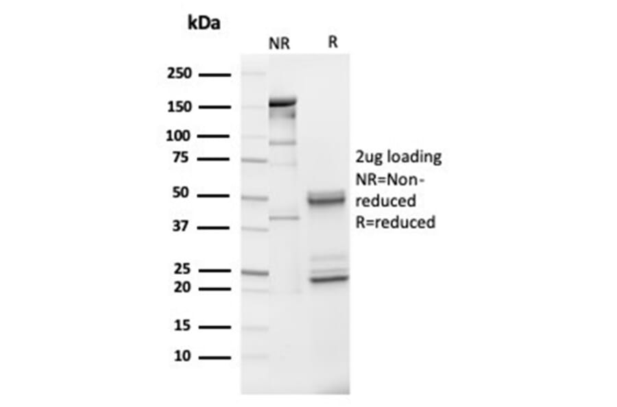 SDS-PAGE - Anti-IGFBP3 Antibody [IGFBP3/3517] (A277661) - Antibodies.com