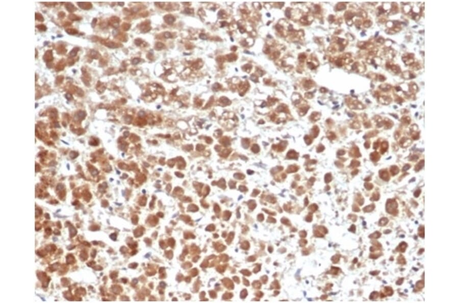 Immunohistochemistry - Anti-IL-1 beta Antibody [IL1B/6687] (A277662) - Antibodies.com