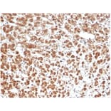 Immunohistochemistry - Anti-IL-1 beta Antibody [IL1B/6687] (A277662) - Antibodies.com