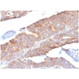 Immunohistochemistry - Anti-IL-1 beta Antibody [IL1B/3993] (A277663) - Antibodies.com