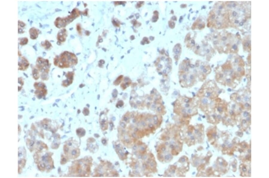 Immunohistochemistry - Anti-IL-1 beta Antibody [IL1B/3993] (A277663) - Antibodies.com