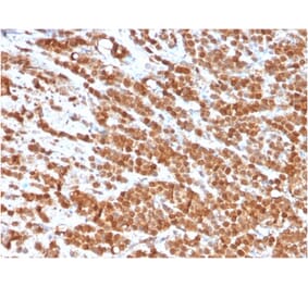 Immunohistochemistry - Anti-IL-2 Antibody [IL2/3949] (A277665) - Antibodies.com