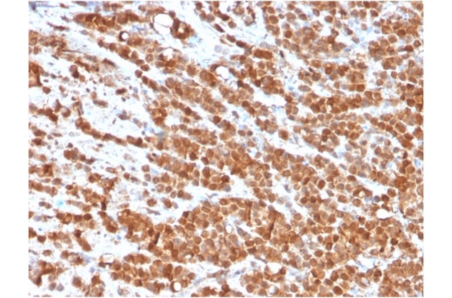Immunohistochemistry - Anti-IL-2 Antibody [IL2/3949] (A277665) - Antibodies.com
