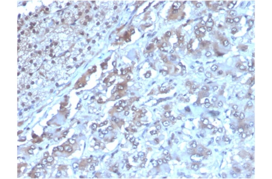 Immunohistochemistry - Anti-IL-2 Antibody [IL2/3949] (A277665) - Antibodies.com