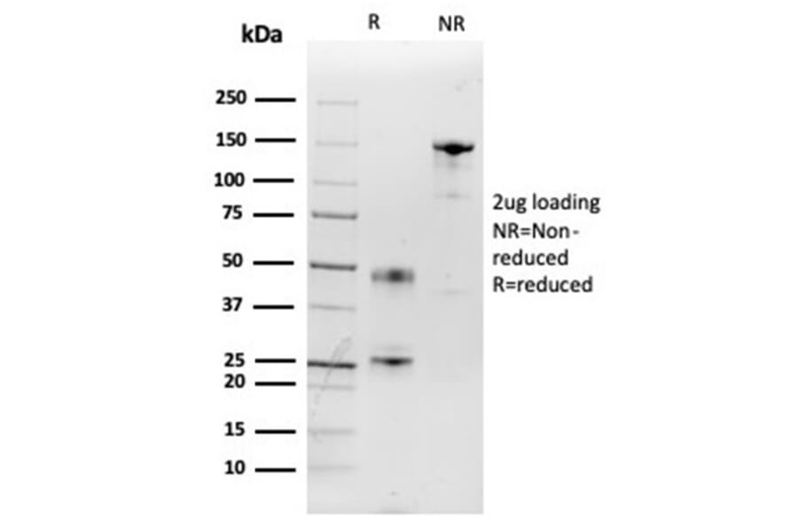 SDS-PAGE - Anti-IL-2 Antibody [IL2/3949] (A277665) - Antibodies.com