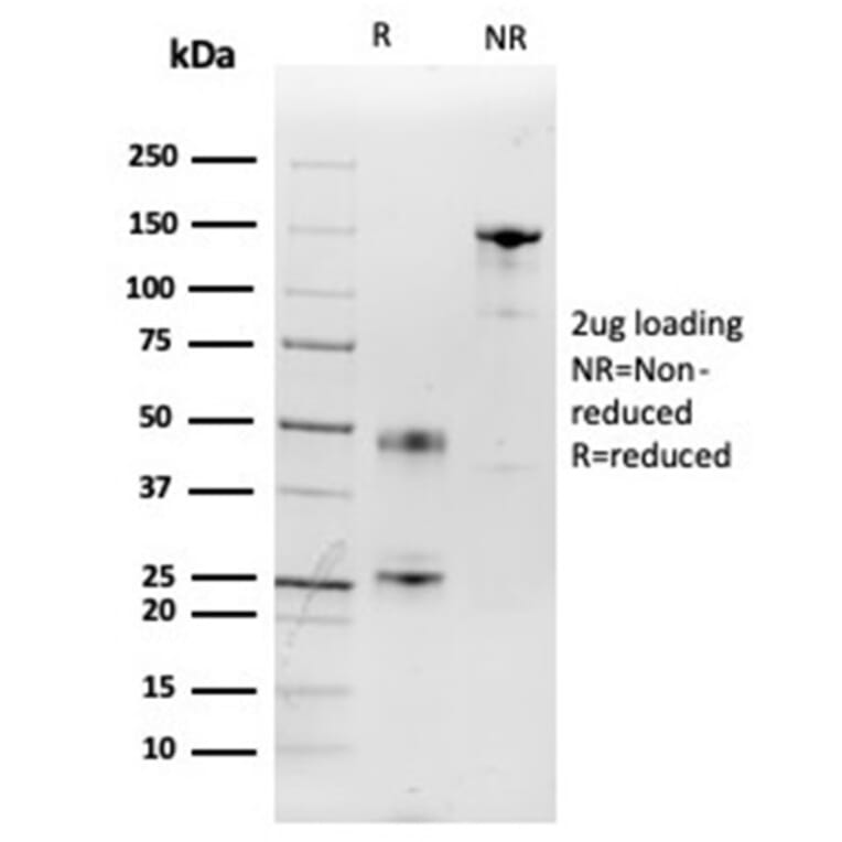 SDS-PAGE - Anti-IL-2 Antibody [IL2/3949] (A277665) - Antibodies.com