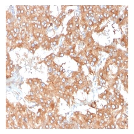 Immunohistochemistry - Anti-IL-2 Antibody [IL2/3950] (A277666) - Antibodies.com