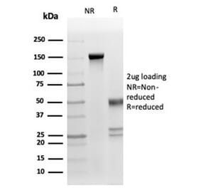 SDS-PAGE - Anti-Fas Ligand Antibody [FASLG/4453] (A277667) - Antibodies.com