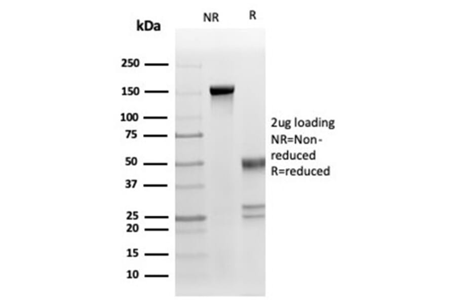 SDS-PAGE - Anti-Fas Ligand Antibody [FASLG/4453] (A277667) - Antibodies.com