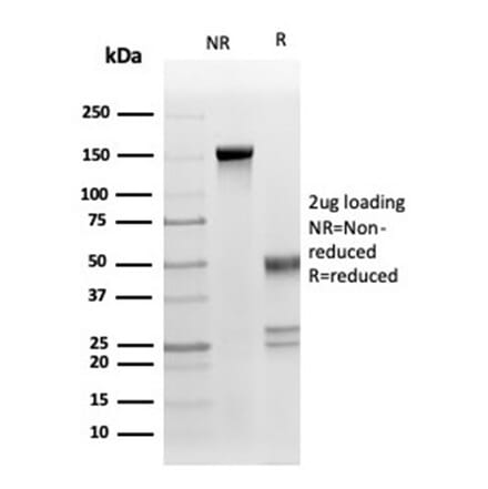 SDS-PAGE - Anti-Fas Ligand Antibody [FASLG/4453] (A277667) - Antibodies.com