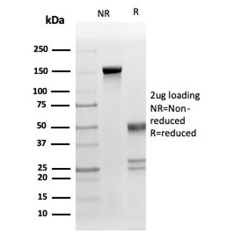 SDS-PAGE - Anti-Fas Ligand Antibody [FASLG/4453] (A277667) - Antibodies.com