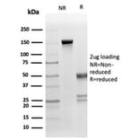 SDS-PAGE - Anti-Fas Ligand Antibody [FASLG/4453] (A277667) - Antibodies.com