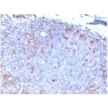 Immunohistochemistry - Anti-Fas Ligand Antibody [FASLG/4453] (A277667) - Antibodies.com