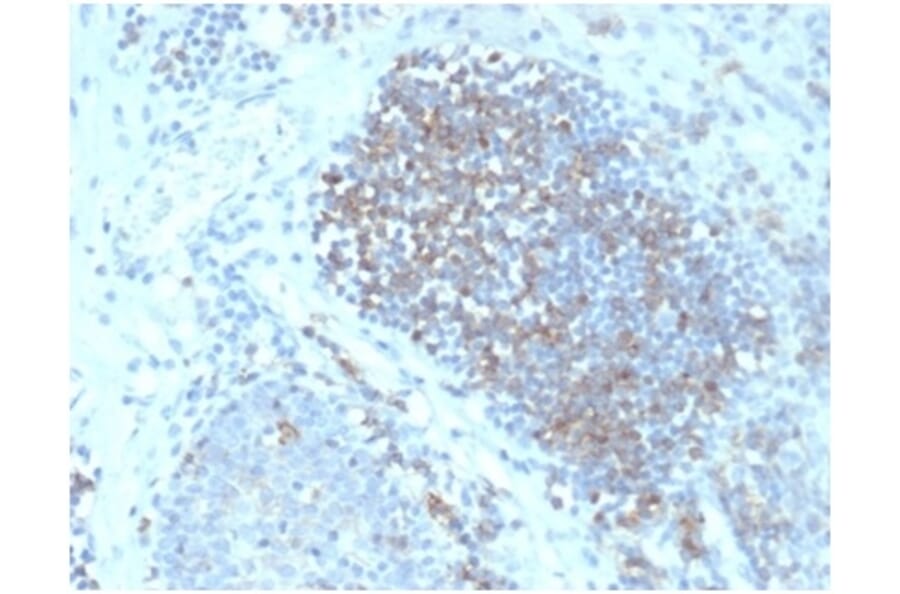 Immunohistochemistry - Anti-Fas Ligand Antibody [FASLG/4456] (A277668) - Antibodies.com