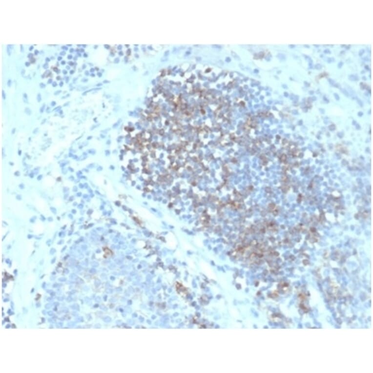 Immunohistochemistry - Anti-Fas Ligand Antibody [FASLG/4456] (A277668) - Antibodies.com