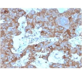 Immunohistochemistry - Anti-IL-3 Antibody [IL3/4004] (A277669) - Antibodies.com