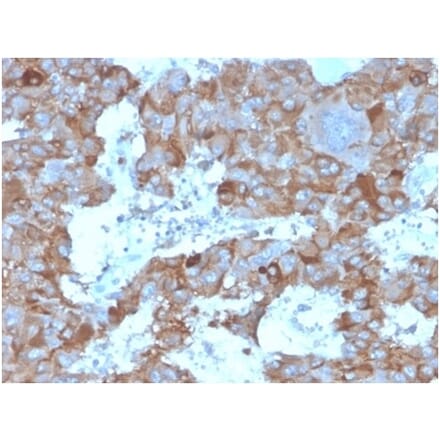 Immunohistochemistry - Anti-IL-3 Antibody [IL3/4004] (A277669) - Antibodies.com