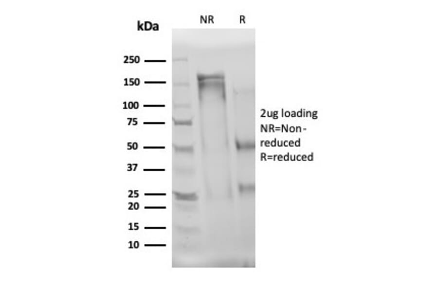 SDS-PAGE - Anti-IL-3 Antibody [IL3/4004] (A277669) - Antibodies.com