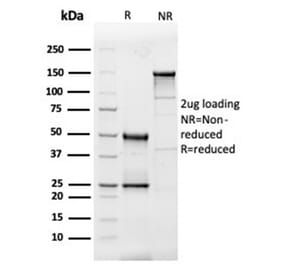 SDS-PAGE - Anti-IL-3 Antibody [IL3/4005] (A277670) - Antibodies.com