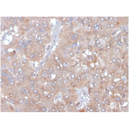 Immunohistochemistry - Anti-IL-5 Antibody [IL5/4161] (A277671) - Antibodies.com