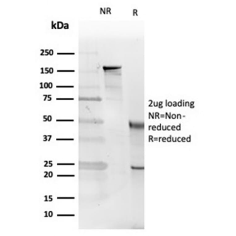 SDS-PAGE - Anti-IL-5 Antibody [IL5/4161] (A277671) - Antibodies.com