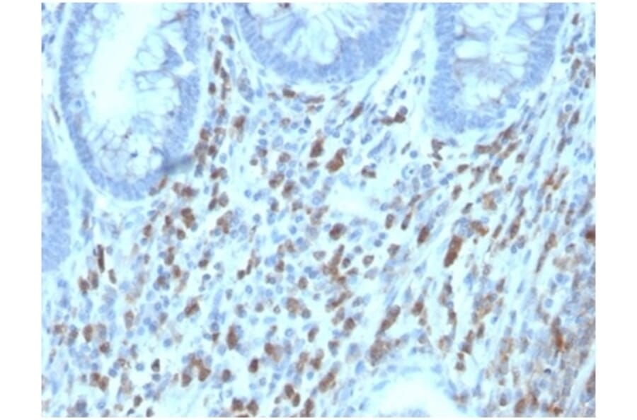 Immunohistochemistry - Anti-CD130 (gp130) Antibody [IL6ST/4101] (A277672) - Antibodies.com