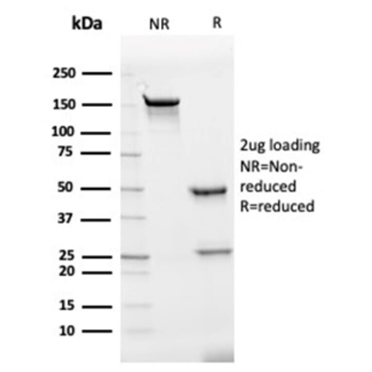 SDS-PAGE - Anti-IL-7 Antibody [IL7/4012] (A277673) - Antibodies.com