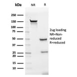SDS-PAGE - Anti-IL-7 Antibody [IL7/4012] (A277673) - Antibodies.com