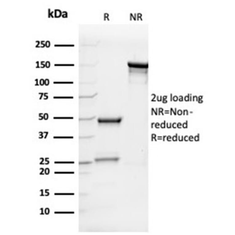 SDS-PAGE - Anti-IL-7 Antibody [IL7/4013] (A277674) - Antibodies.com