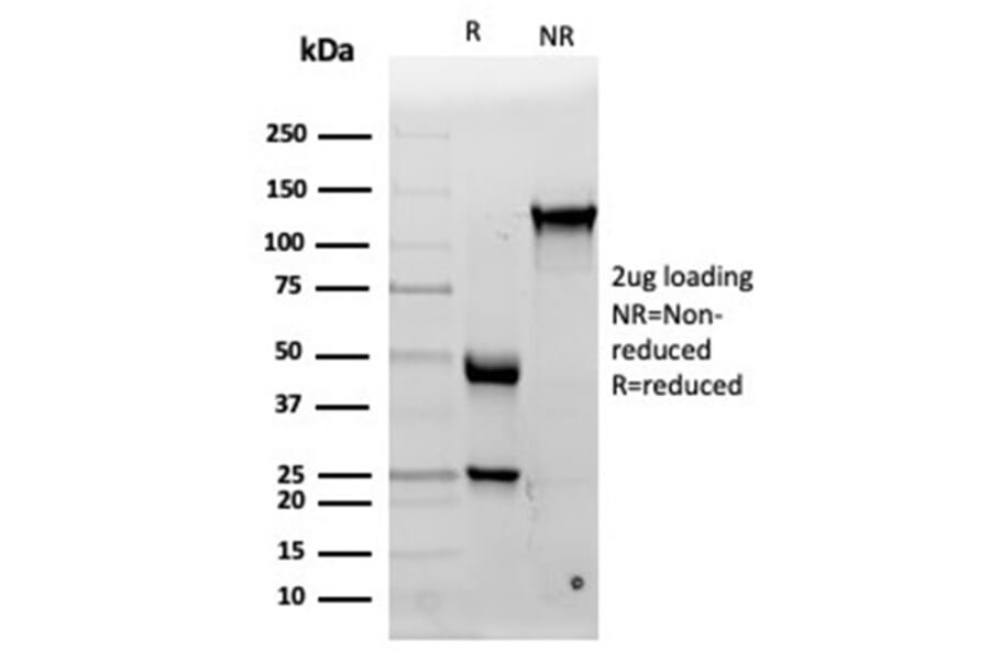 SDS-PAGE - Anti-IL-15 Antibody [IL15/4353] (A277675) - Antibodies.com