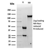 SDS-PAGE - Anti-IL-15 Antibody [IL15/4353] (A277675) - Antibodies.com