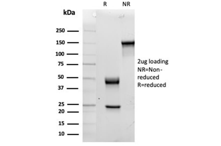 SDS-PAGE - Anti-IL-15 Antibody [IL15/4354] (A277676) - Antibodies.com