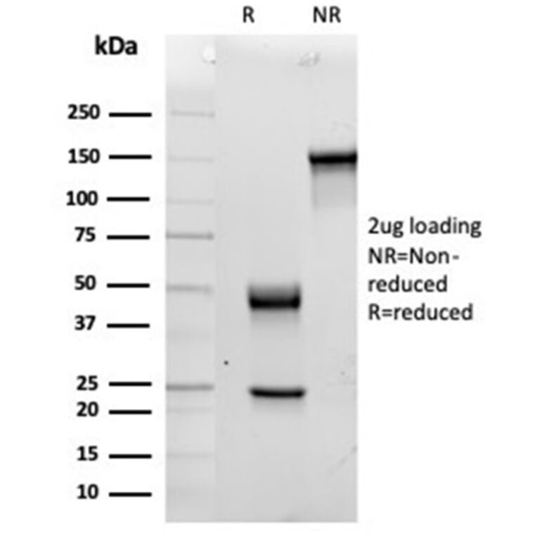 SDS-PAGE - Anti-IL-15 Antibody [IL15/4354] (A277676) - Antibodies.com