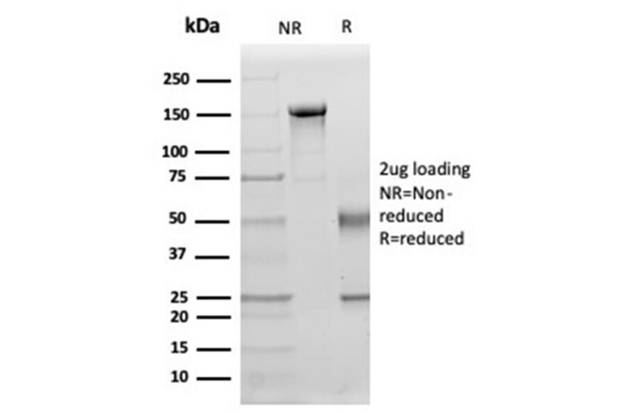 SDS-PAGE - Anti-IL-15 Antibody [IL15/4354] (A277677) - Antibodies.com