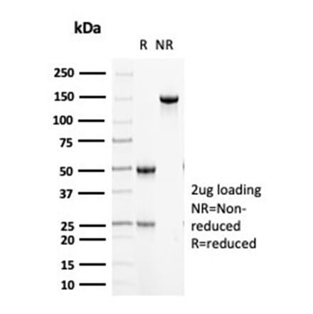 SDS-PAGE - Anti-Cytokeratin 5 Antibody [KRT5/6466] (A277681) - Antibodies.com