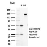 SDS-PAGE - Anti-Cytokeratin 5 Antibody [KRT5/6466] (A277681) - Antibodies.com