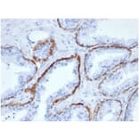 Immunohistochemistry - Anti-Cytokeratin 5 Antibody [KRT5/6466] (A277681) - Antibodies.com