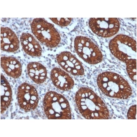 Immunohistochemistry - Anti-Cytokeratin 8 Antibody [KRT8/4006] (A277682) - Antibodies.com