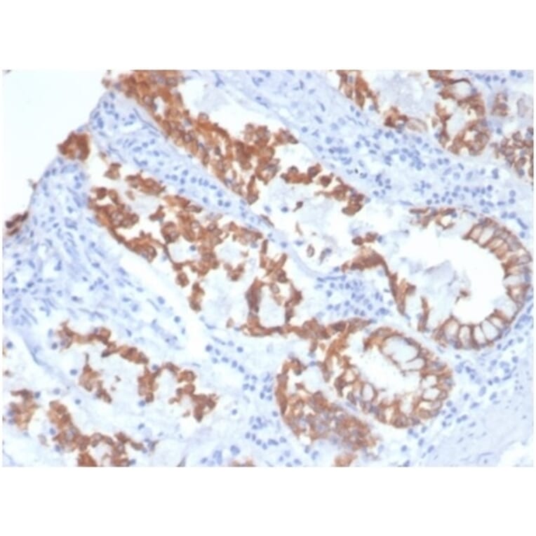 Immunohistochemistry - Anti-Cytokeratin 8 Antibody [KRT8/4006] (A277682) - Antibodies.com
