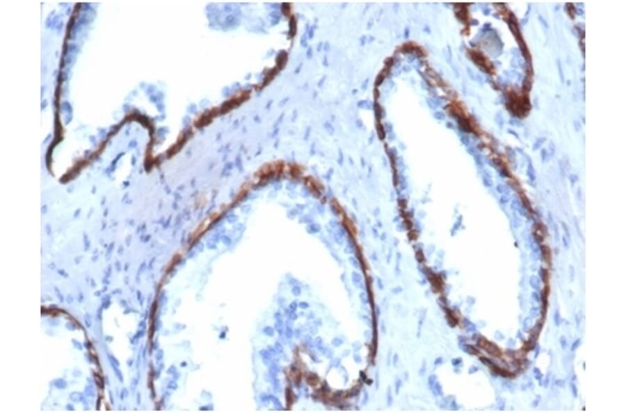 Immunohistochemistry - Anti-Cytokeratin 14 Antibody [KRT14/4130] (A277683) - Antibodies.com