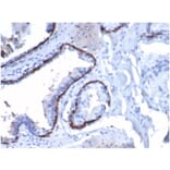 Immunohistochemistry - Anti-Cytokeratin 14 Antibody [KRT14/4130] (A277683) - Antibodies.com