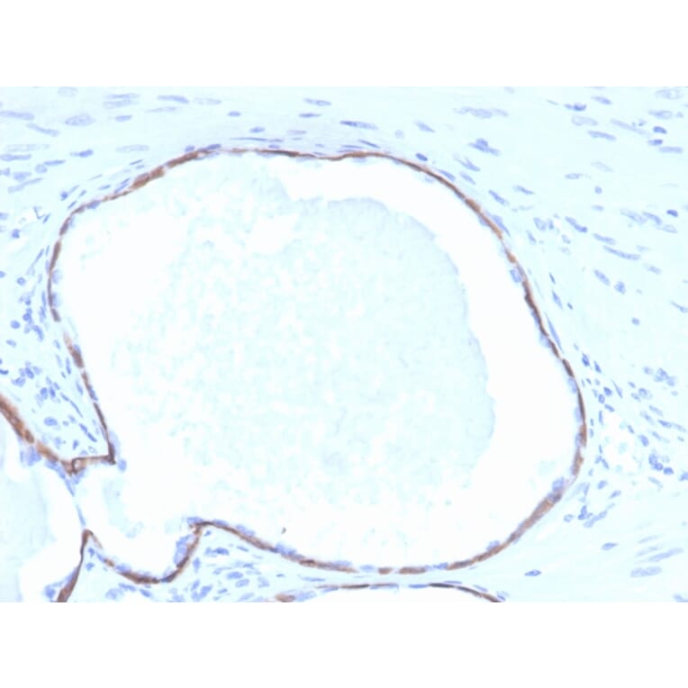 Immunohistochemistry - Anti-Cytokeratin 14 Antibody [KRT14/4132] (A277684) - Antibodies.com
