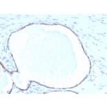 Immunohistochemistry - Anti-Cytokeratin 14 Antibody [KRT14/4132] (A277684) - Antibodies.com
