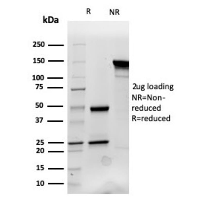 SDS-PAGE - Anti-Cytokeratin 14 Antibody [KRT14/4132] (A277684) - Antibodies.com
