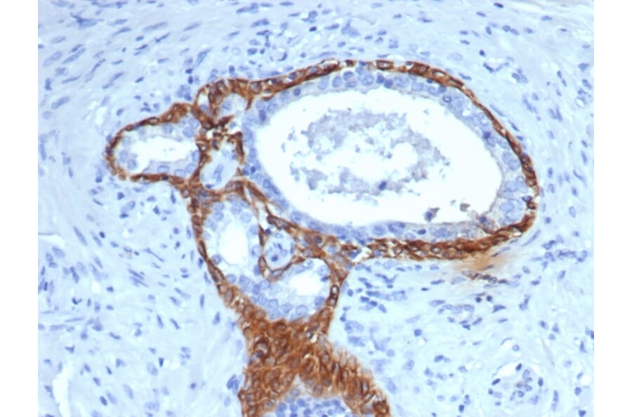 Immunohistochemistry - Anti-Cytokeratin 14 Antibody [KRT14/4133] (A277685) - Antibodies.com