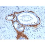 Immunohistochemistry - Anti-Cytokeratin 14 Antibody [KRT14/4133] (A277685) - Antibodies.com
