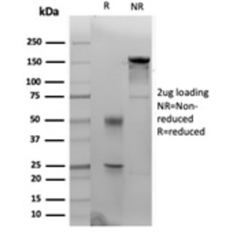 SDS-PAGE - Anti-Cytokeratin 14 Antibody [KRT14/4133] (A277685) - Antibodies.com